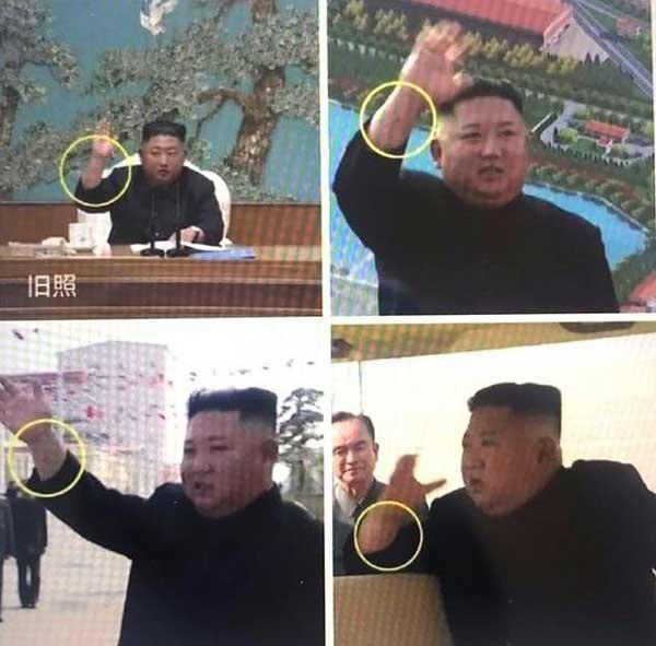 حدس درباره اینکه رهبر کره شمالی بدل دارد